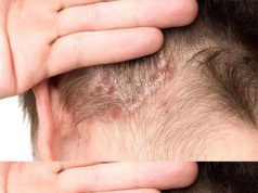 Found this on my son’s scalp. Have no idea what it is and we can’t get a doc appt soon. Tips?